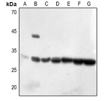 Anti-ECI1 Antibody