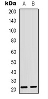 Anti-CD300d Antibody