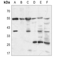 Prolactin antibody