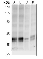 Anti-p38 (Phospho-T180/Y182) Antibody