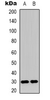 Anti-MMTAG2 Antibody