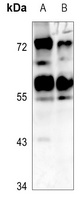 CADM1 antibody