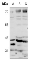 MRPS22 antibody