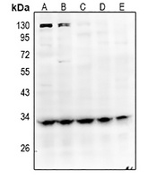 Anti-GPR40 Antibody