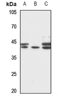 Anti-RRS1 Antibody