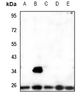 Anti-MRRF Antibody
