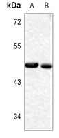 Anti-YBX1 (Phospho-S102) Antibody