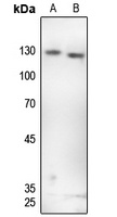 Anti-GKAP Antibody