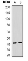Anti-TBX10 Antibody