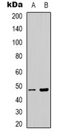 Anti-PSKH1 Antibody