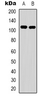 EPHA1 antibody