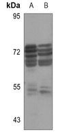 GK antibody