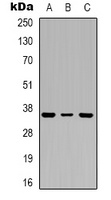 Anti-PIG3 Antibody