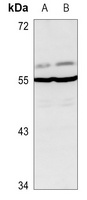 Anti-Glycerate Kinase Antibody
