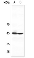 Anti-ZNF785 Antibody