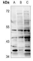 BTBD6 antibody