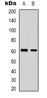 Anti-YTHDF1 Antibody