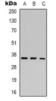 Anti-HEY2 Antibody