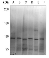 ZC3H7B antibody