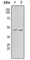 CHKB antibody