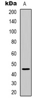 ARRDC2 antibody