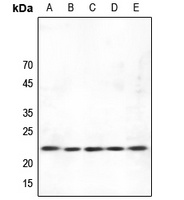 ASF1B antibody