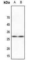 HSPB2 antibody