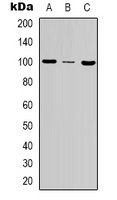 Anti-MSH2 Antibody