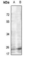 MRPL22 antibody