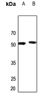 AGXT2L2 antibody