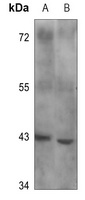 B4GALT1 antibody