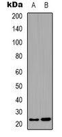 Anti-BCAS4 Antibody