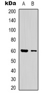 Anti-CLIP3 Antibody