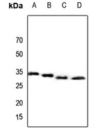 CBR3 antibody