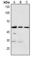 RRP8 antibody