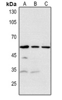 Anti-RRP8 Antibody