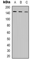 Anti-POLR3A Antibody