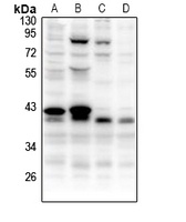 Anti-CCNB1IP1 Antibody