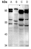 GABRD antibody