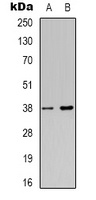 Anti-NDRG4 Antibody