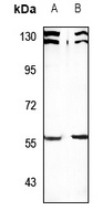 Anti-SESN1 Antibody