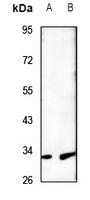Anti-MTIF3 Antibody