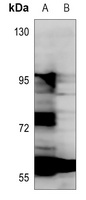 Anti-ANGPTL1 Antibody