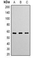 Anti-Angiopoietin-1 Antibody