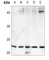 Anti-FGF9 Antibody