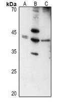 Anti-Layilin Antibody