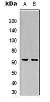 Anti-GLUT5 Antibody