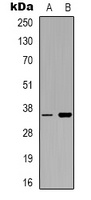 F11R antibody