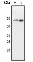 Anti-CD316 Antibody