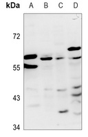 ZNF384 antibody